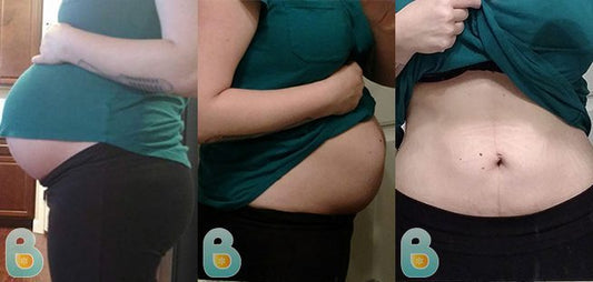 259-Bryttanie-C-Bellefit-Results-Before-and-After-Bellefit-SLIDE