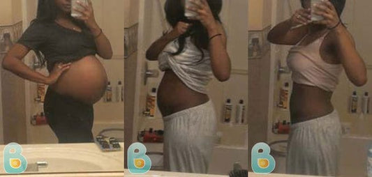 26-Brittany-S-Bellefit-Results-Before-and-After-Bellefit-SLIDE