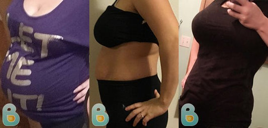 260-Alexandria-W-Bellefit-Results-Before-and-After-Bellefit-SLIDE