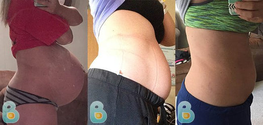 262-Kelli-R-Bellefit-Results-Before-and-After-Bellefit-SLIDE