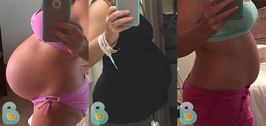 263-Andria-G-Bellefit-Results-Before-and-After-Bellefit-SLIDE