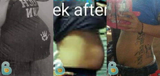 265-Roxanne-B-Bellefit-Results-Before-and-After-Bellefit-SLIDE