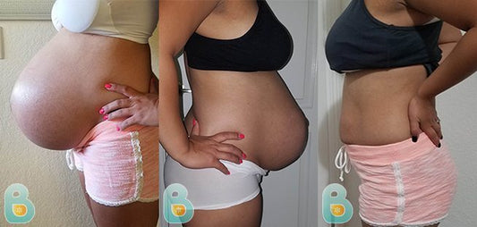268-Monique-B-Bellefit-Results-Before-and-After-Bellefit-SLIDE