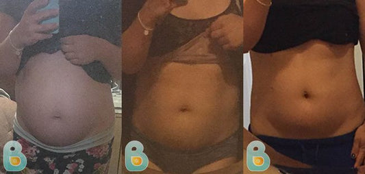 269-Tina-T-Bellefit-Results-Before-and-After-Bellefit-SLIDE