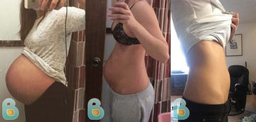 27-Brooke-M-Bellefit-Results-Before-and-After-Bellefit-SLIDE