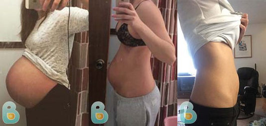 27-Brooke-M-Bellefit-Results-Before-and-After-Bellefit-SLIDE