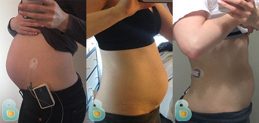 271-Anna-B-Bellefit-Results-Before-and-After-Bellefit-SLIDE