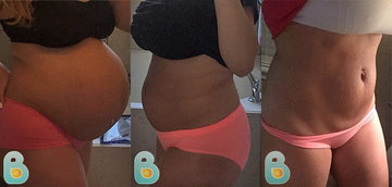 272-Laura-Ashley-M-Bellefit-Results-Before-and-After-Bellefit-SLIDE