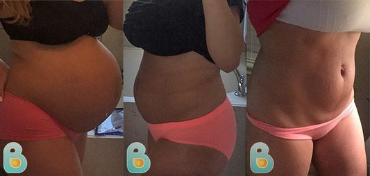 272-Laura-Ashley-M-Bellefit-Results-Before-and-After-Bellefit-SLIDE