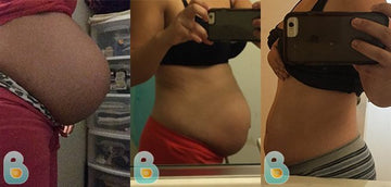 273-Lissette-O-Bellefit-Results-Before-and-After-Bellefit-SLIDE