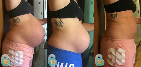 274-Kelsie-B-Bellefit-Results-Before-and-After-Bellefit-SLIDE