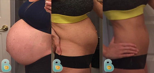 275-Tiffany-M-Bellefit-Results-Before-and-After-Bellefit-SLIDE