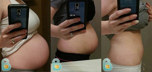 277-Erin-B-Bellefit-Results-Before-and-After-Bellefit-SLIDE