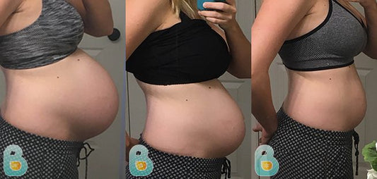 278-Keri-S-Bellefit-Results-Before-and-After-Bellefit-SLIDE