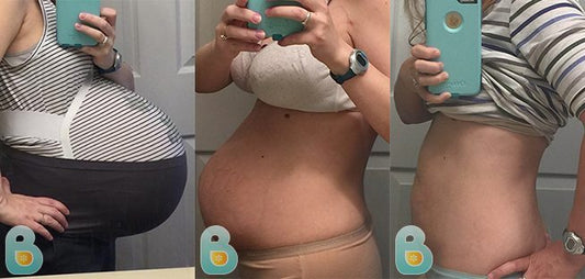 279-Laura-B-Bellefit-Results-Before-and-After-Bellefit-SLIDE
