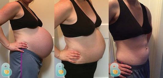 28-Caroline-W-Bellefit-Results-Before-and-After-Bellefit-SLIDE