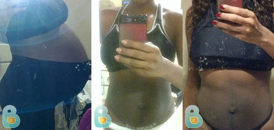 281-Arianna-H-Bellefit-Results-Before-and-After-Bellefit-SLIDE