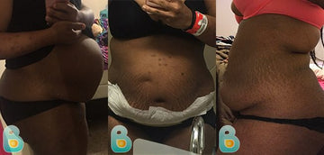 283-Erica-K-Bellefit-Results-Before-and-After-Bellefit-SLIDE