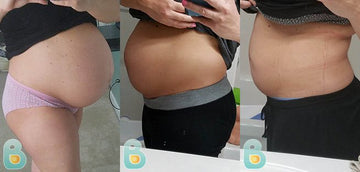 285-Tanya-B-Bellefit-Results-Before-and-After-Bellefit-SLIDE