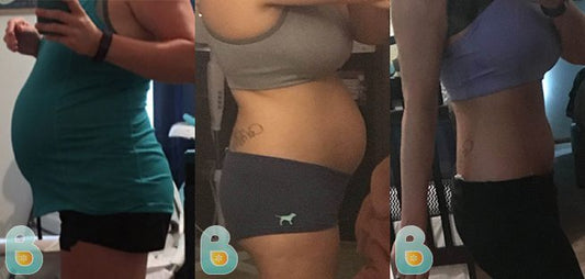 286-Mikayla-P-Bellefit-Results-Before-and-After-Bellefit-SLIDE