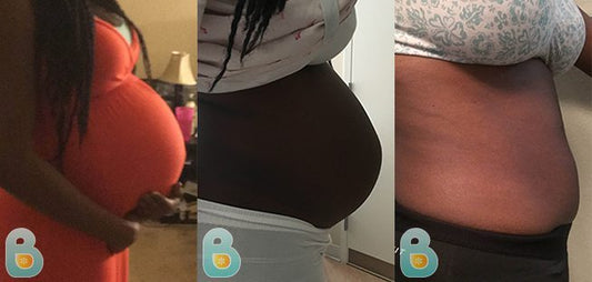 287-Katlin-H-Bellefit-Results-Before-and-After-Bellefit-SLIDE