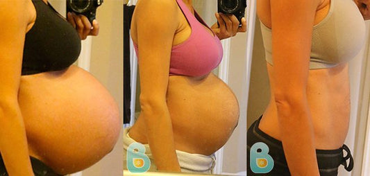 288-Michelle-M-Bellefit-Results-Before-and-After-Bellefit-SLIDE
