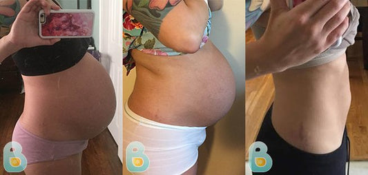 291-Dana-H-Bellefit-Results-Before-and-After-Bellefit-SLIDE