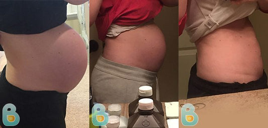 292-Whitnie-B-Bellefit-Results-Before-and-After-Bellefit-SLIDE