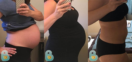 294-Tiffany-G-Bellefit-Results-Before-and-After-Bellefit-SLIDE