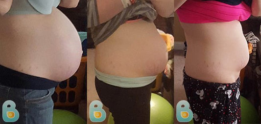 295-Marissa-V-Bellefit-Results-Before-and-After-Bellefit-SLIDE
