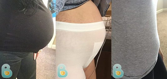 297-Maria-G-Bellefit-Results-Before-and-After-Bellefit-SLIDE