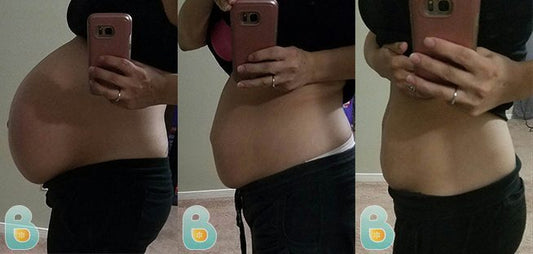 298-Blanca-C-Bellefit-Results-Before-and-After-Bellefit-SLIDE