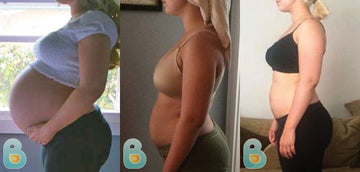 3-Alexandria-P-Bellefit-Results-Before-and-After-Bellefit-SLIDE