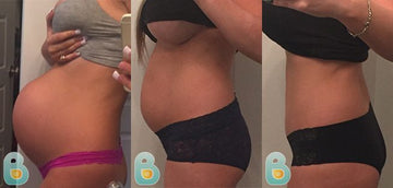 300-Alexandria-B-Bellefit-Results-Before-and-After-Bellefit-SLIDE
