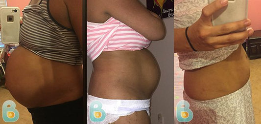 301-Victoria-P-Bellefit-Results-Before-and-After-Bellefit-SLIDE