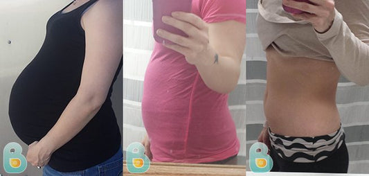 302-Heather-W-Bellefit-Results-Before-and-After-Bellefit-SLIDE