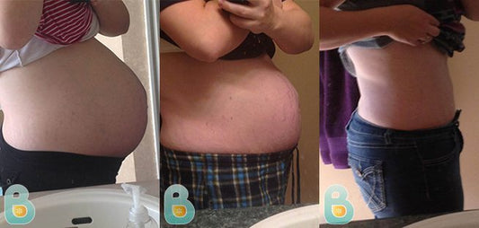 303-Victora-D-Bellefit-Results-Before-and-After-Bellefit-SLIDE