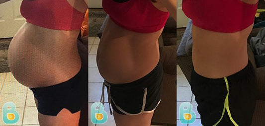 304-Rebecca-S-Bellefit-Results-Before-and-After-Bellefit-SLIDE