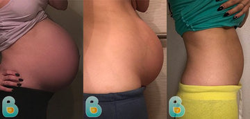 305-Ramineh-W-Bellefit-Results-Before-and-After-Bellefit-SLIDE