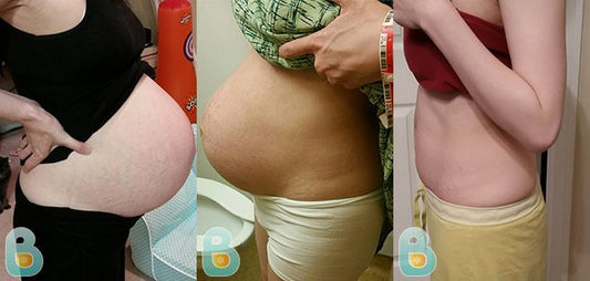 306-Kristen-V-Bellefit-Results-Before-and-After-Bellefit-SLIDE