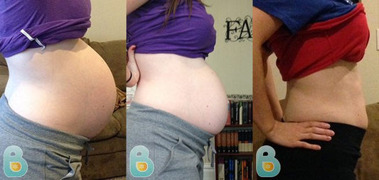 307-Brigitte-C-Bellefit-Results-Before-and-After-Bellefit-SLIDE