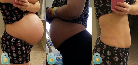 308-Melissa-T-Bellefit-Results-Before-and-After-Bellefit-SLIDE