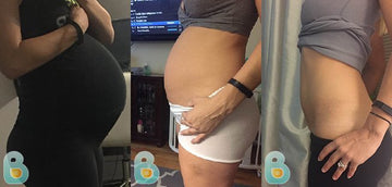 309-Michelle-R-Bellefit-Results-Before-and-After-Bellefit-SLIDE