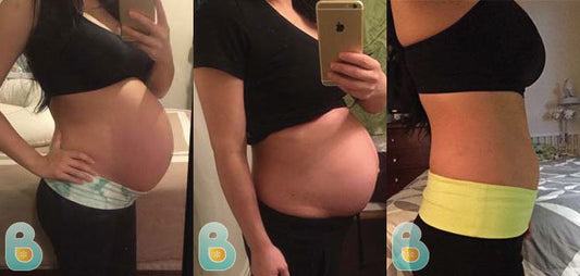 31-Cecilia-S-Bellefit-Results-Before-and-After-Bellefit-SLIDE