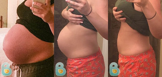 311-Sarah-H-Bellefit-Results-Before-and-After-Bellefit-SLIDE