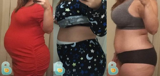 312-Carmen-G-Bellefit-Results-Before-and-After-Bellefit-SLIDE