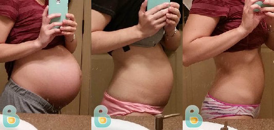 313-Maria-S-Bellefit-Results-Before-and-After-Bellefit-SLIDE