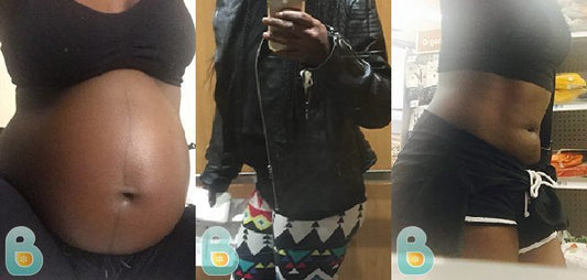 315-Chanette-W-Bellefit-Results-Before-and-After-Bellefit-SLIDE