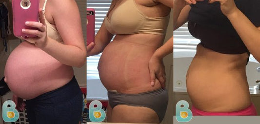 317-Tanya-G-Bellefit-Results-Before-and-After-Bellefit-SLIDE