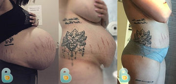 319-Alexandra-H-Bellefit-Results-Before-and-After-Bellefit-SLIDE